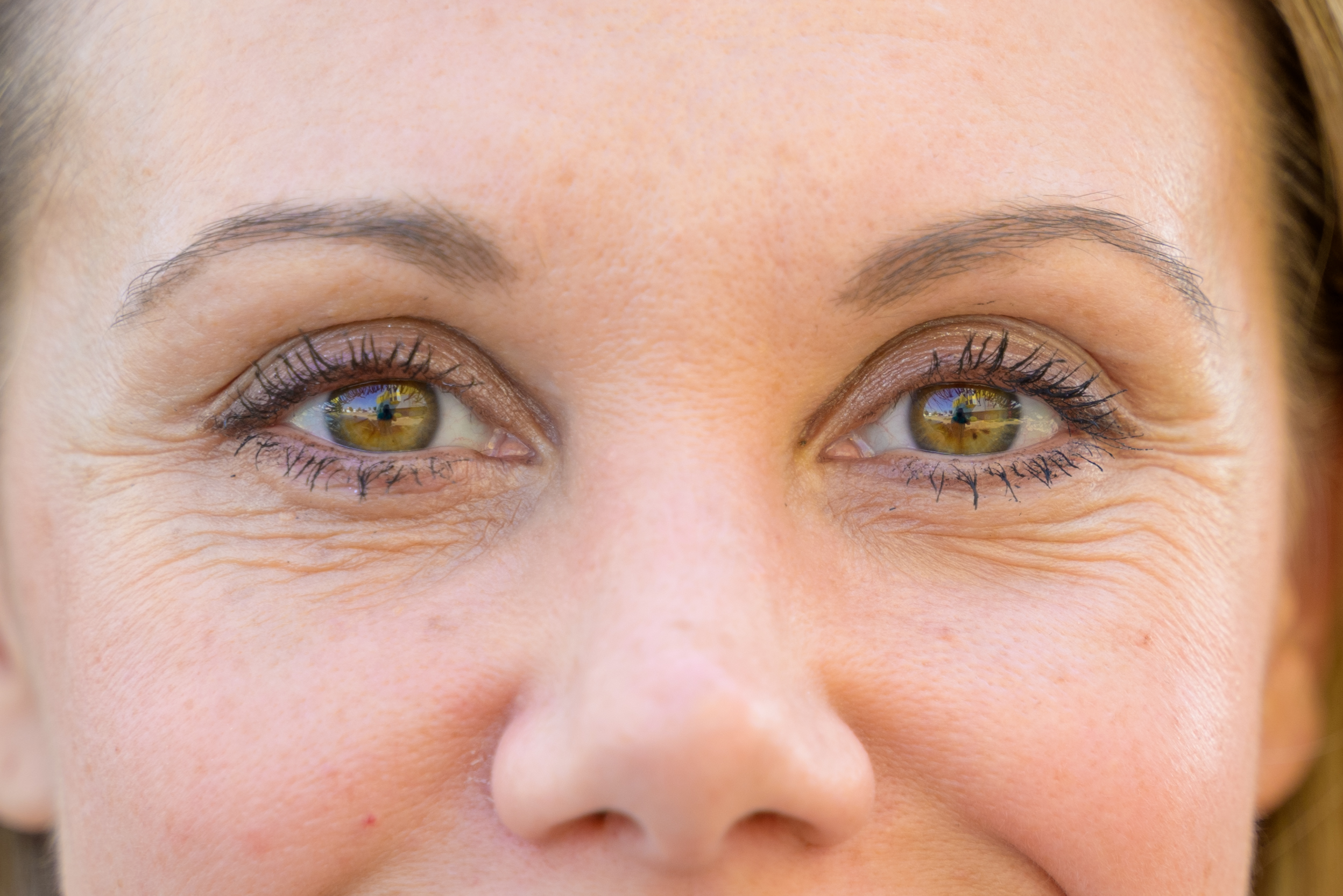 Premium & Standard Cataract Surgery